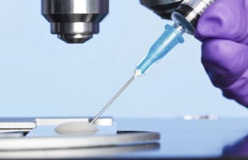 تحديد جنس الجنين تحديد جنس الجنين