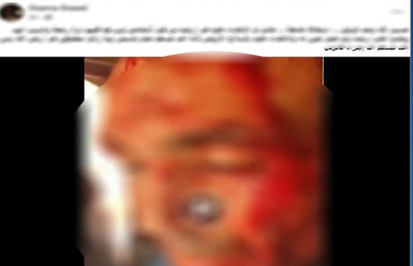 المجني عليه