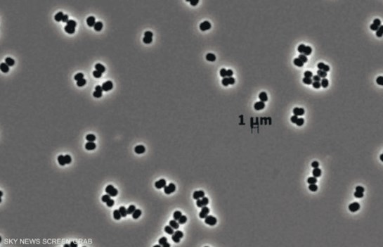 بكتيريا غامضة 