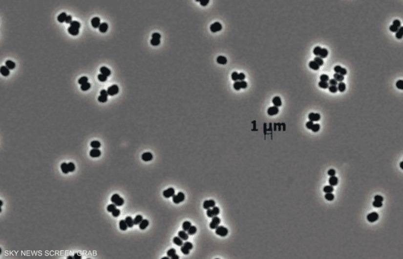 بكتيريا غامضة 