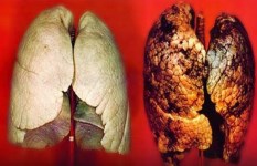 طرق فعالة لتنظيف الرئتين 