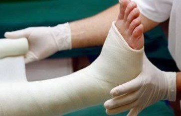 علاج الكسور في دقائق  علاج الكسور في دقائق