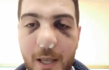 إخلاء سبيل طبيب عظام مستشفى الباجور 