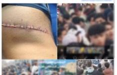 إصابة طالب في مشاجرة مع أصدقاءه بالمنوفية